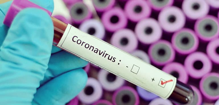 coronavirus Covid-19 lo que debes saber origen, tratamiento, sintomas